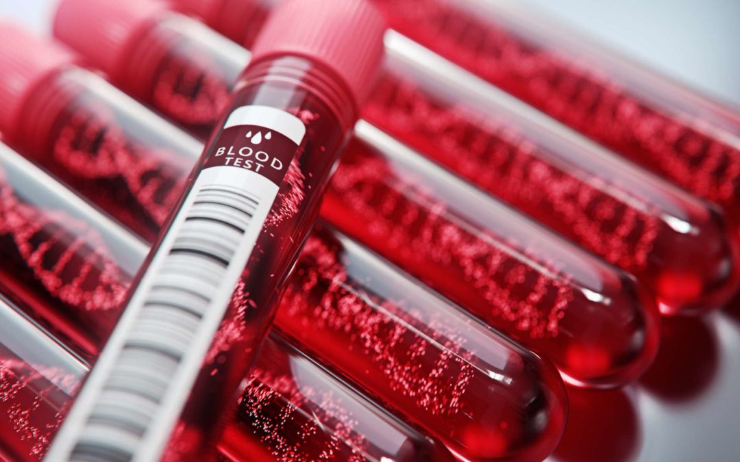 Test ADN sanguin : peut-on utiliser autre chose que du sang pour un test ADN ? 